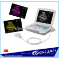 Laptop medizinische Ultraschallgeräte und tragbare Ultraschalldiagnosescanner